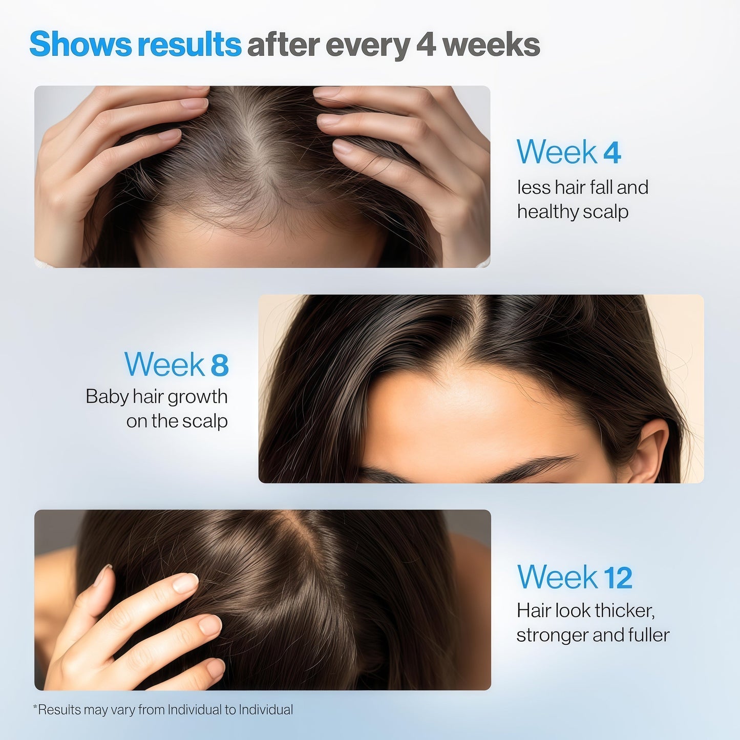 Rosemary Hair Growth Serum Roll On 25 ml – 3% Rosemary, 3% Redensyl & 2% Anagain | DHT-Blocking Scalp Serum Boosts Oxygen Flow, Reduces Hair Fall | Paraben/Sulfate-Free | Women & Men